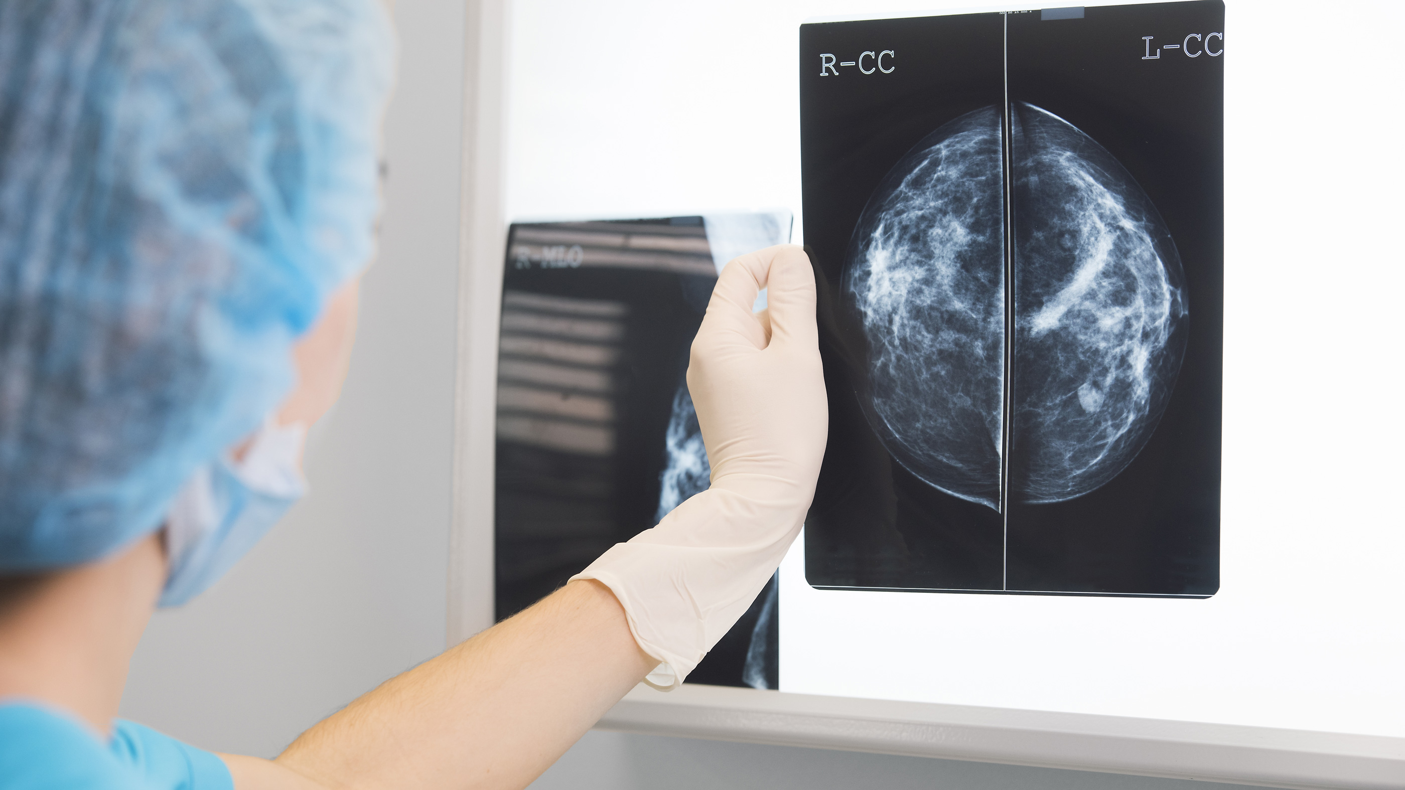 Episode 11: Significant Discoveries in Understanding, Preventing and Treating Breast Cancer