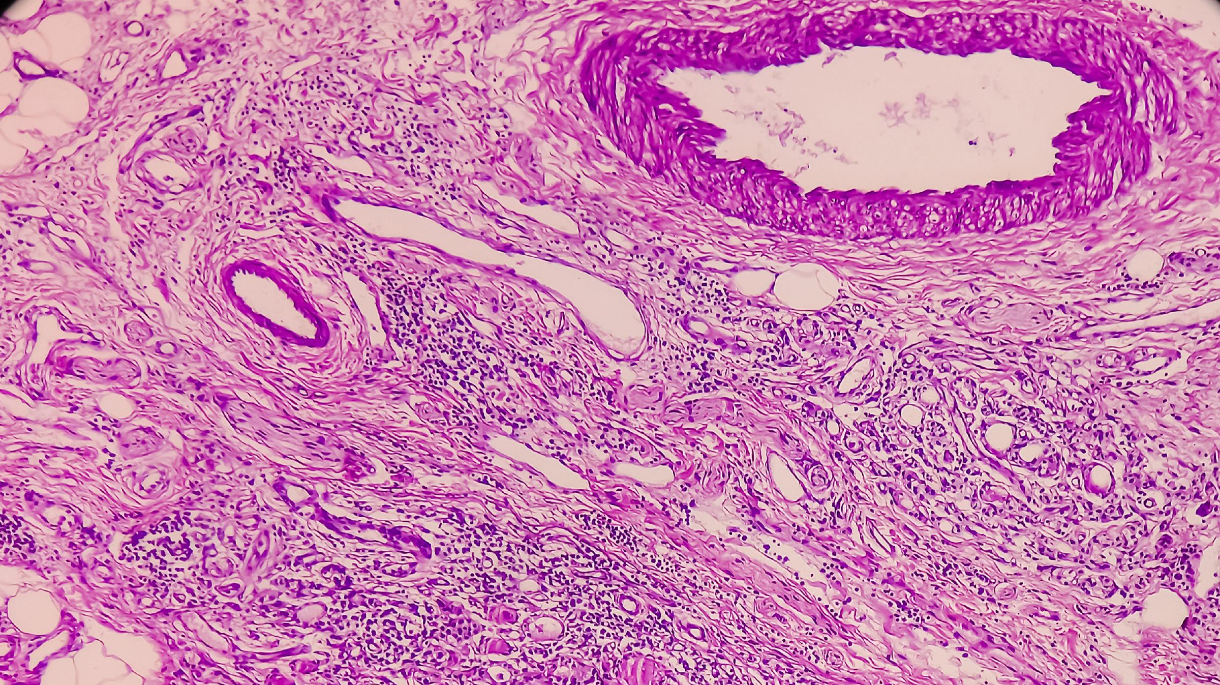 A man receives a skin exam on his back