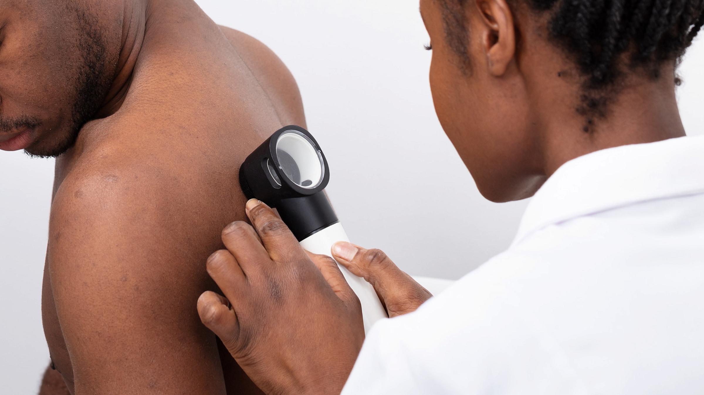 A man receives a skin exam on his back