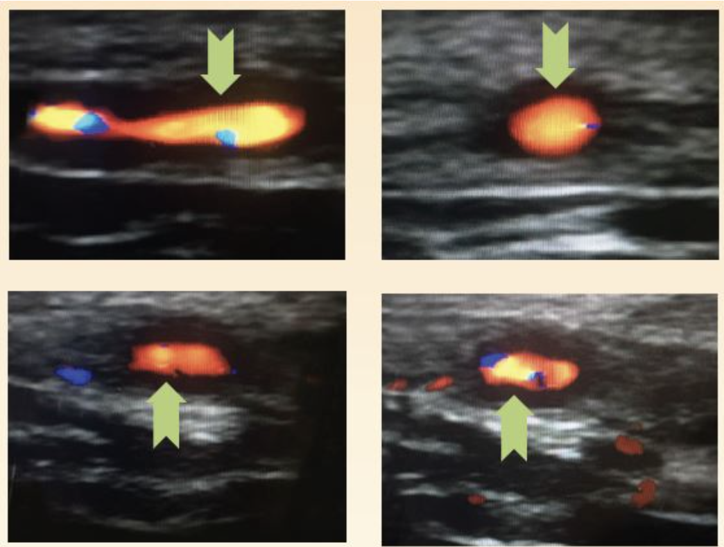 Figure 2b
