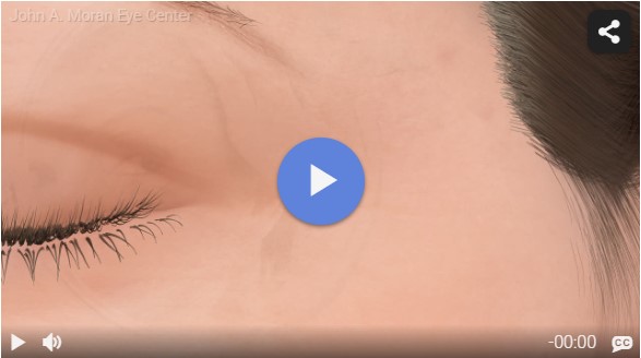 Botox Injections Rendia Video