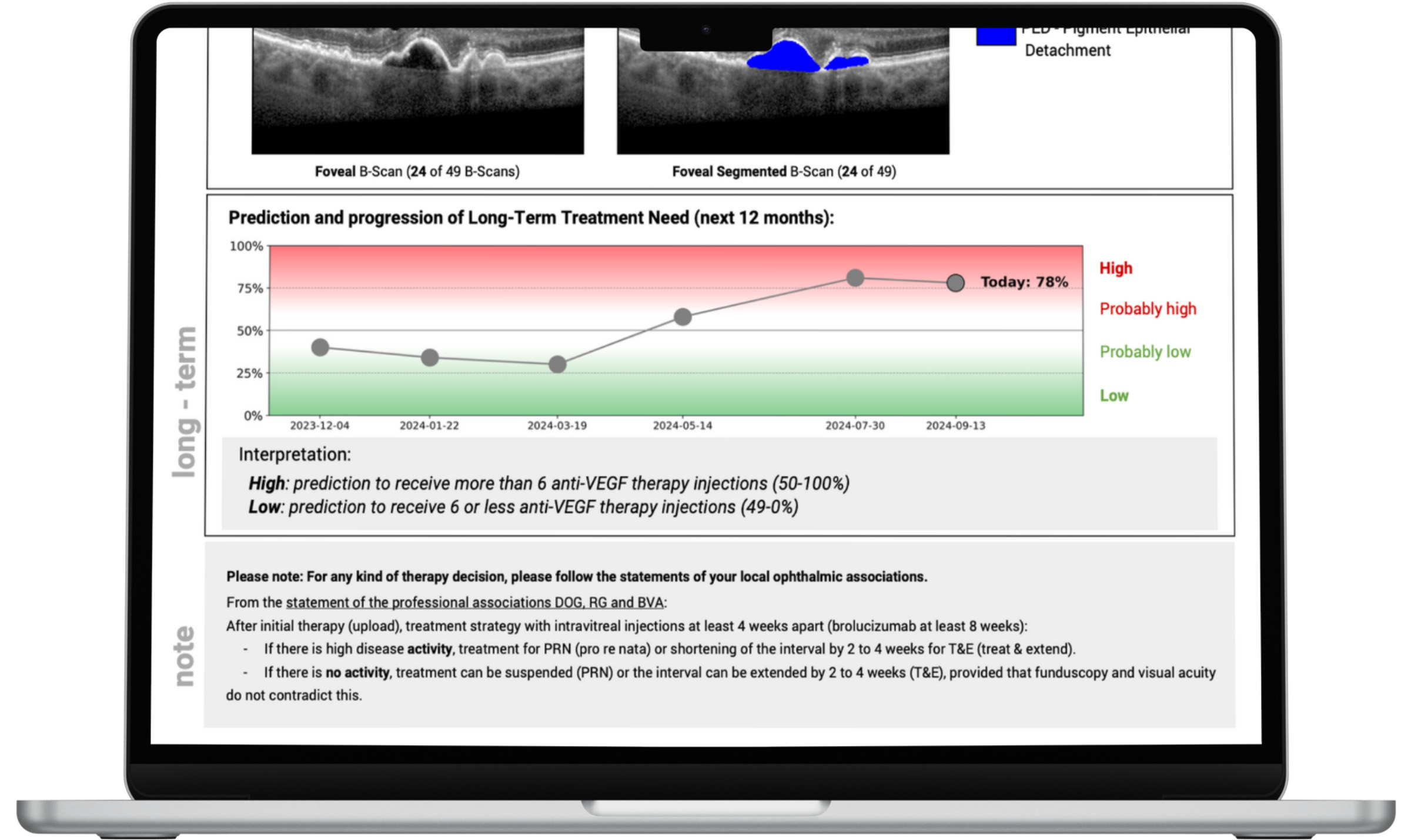A sample of the deepeye? TPS dashboard for ophthalmology therapy management. 