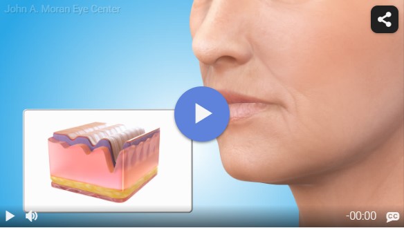 Injectables Rendia Video