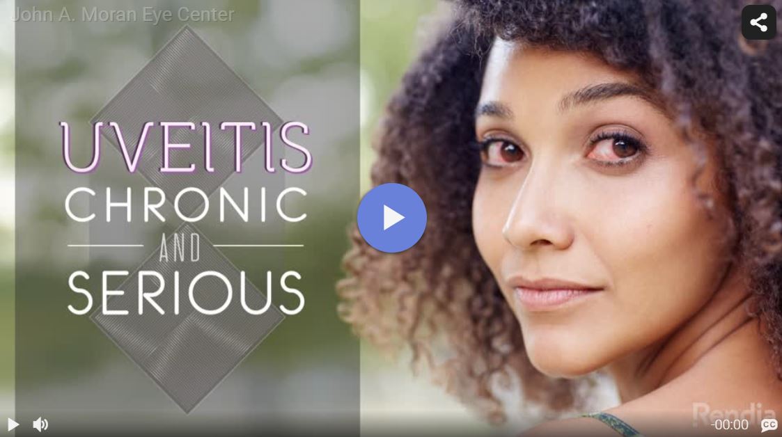 Uveitis and Iritis Video