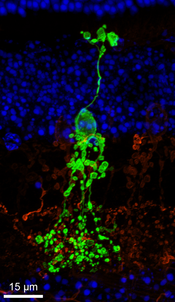 campana cell image