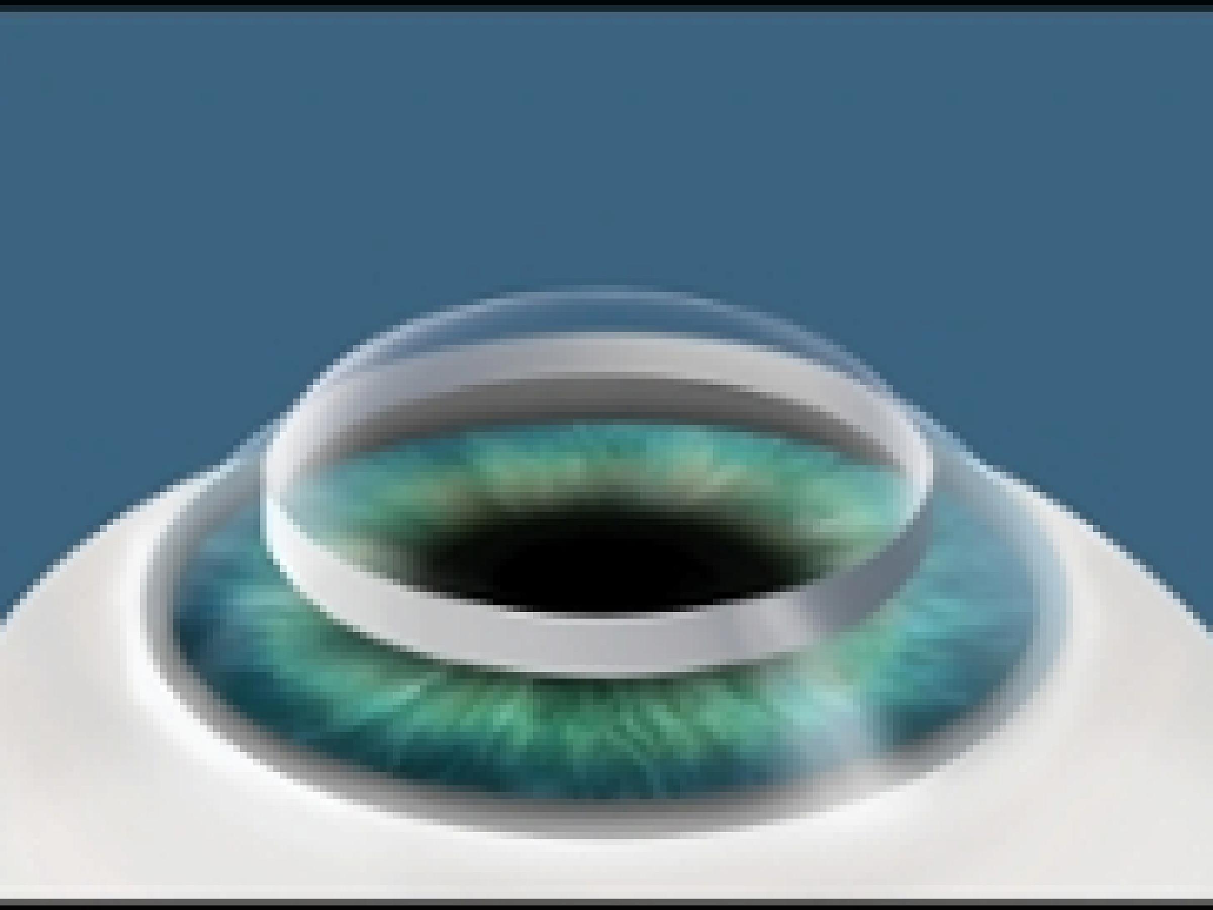 Surgeon will suture the donor cornea into place