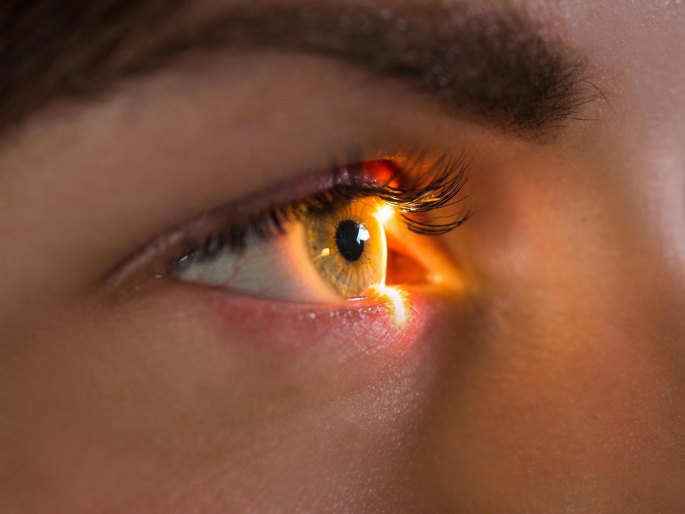 Image of an eye exam.