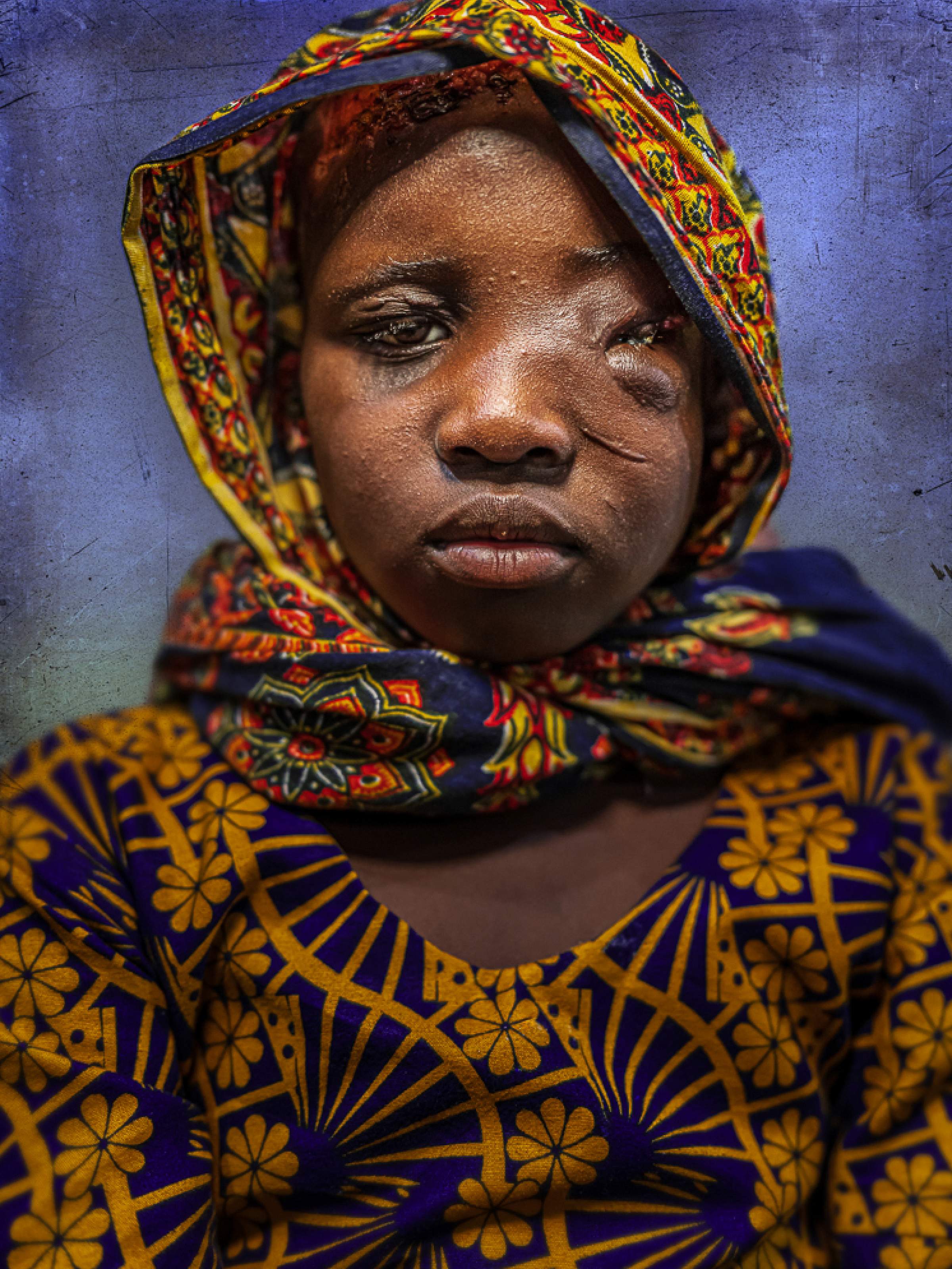 Tanzania hyena attack victim 2025