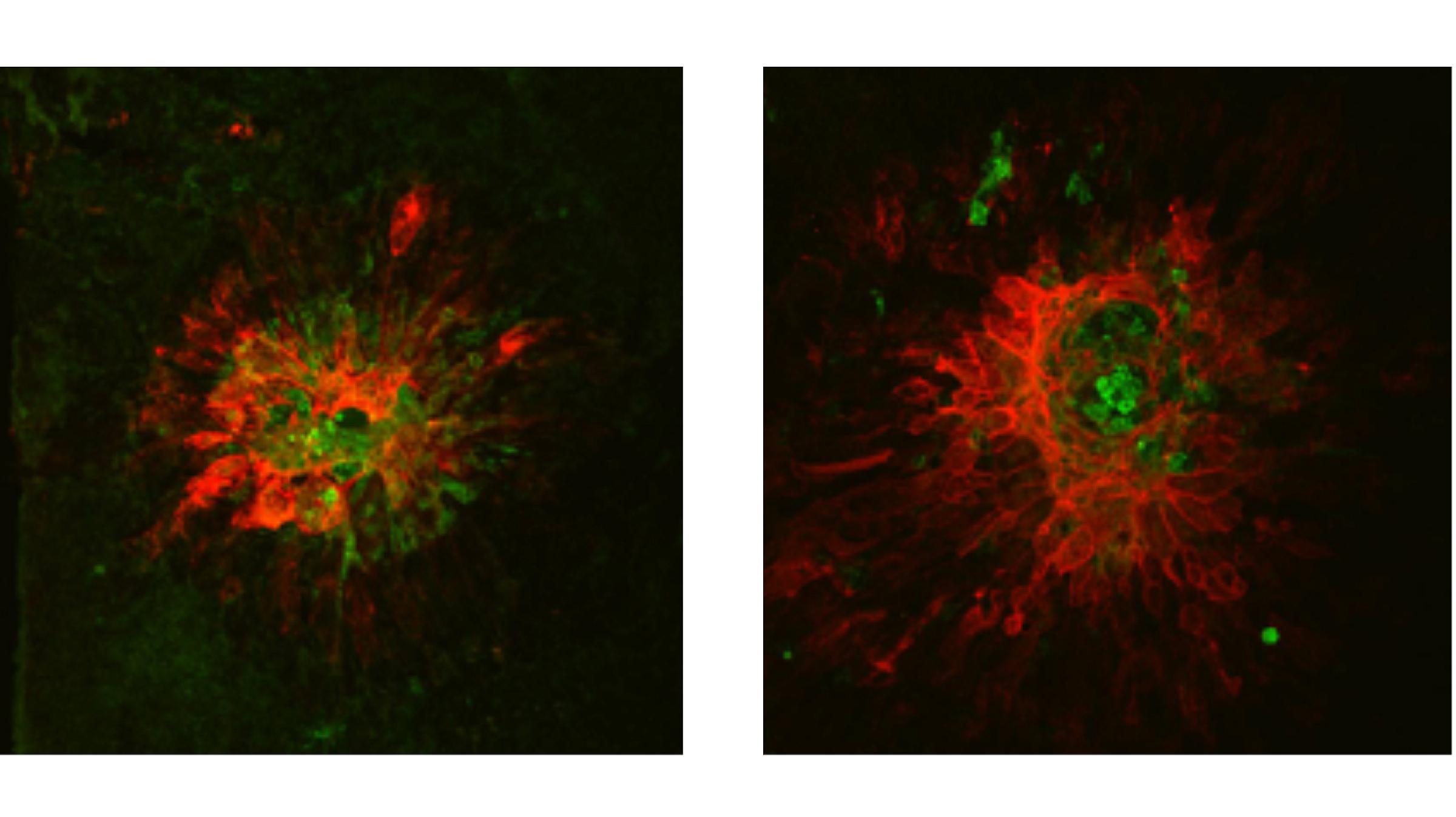 7-ketocholesterol research images