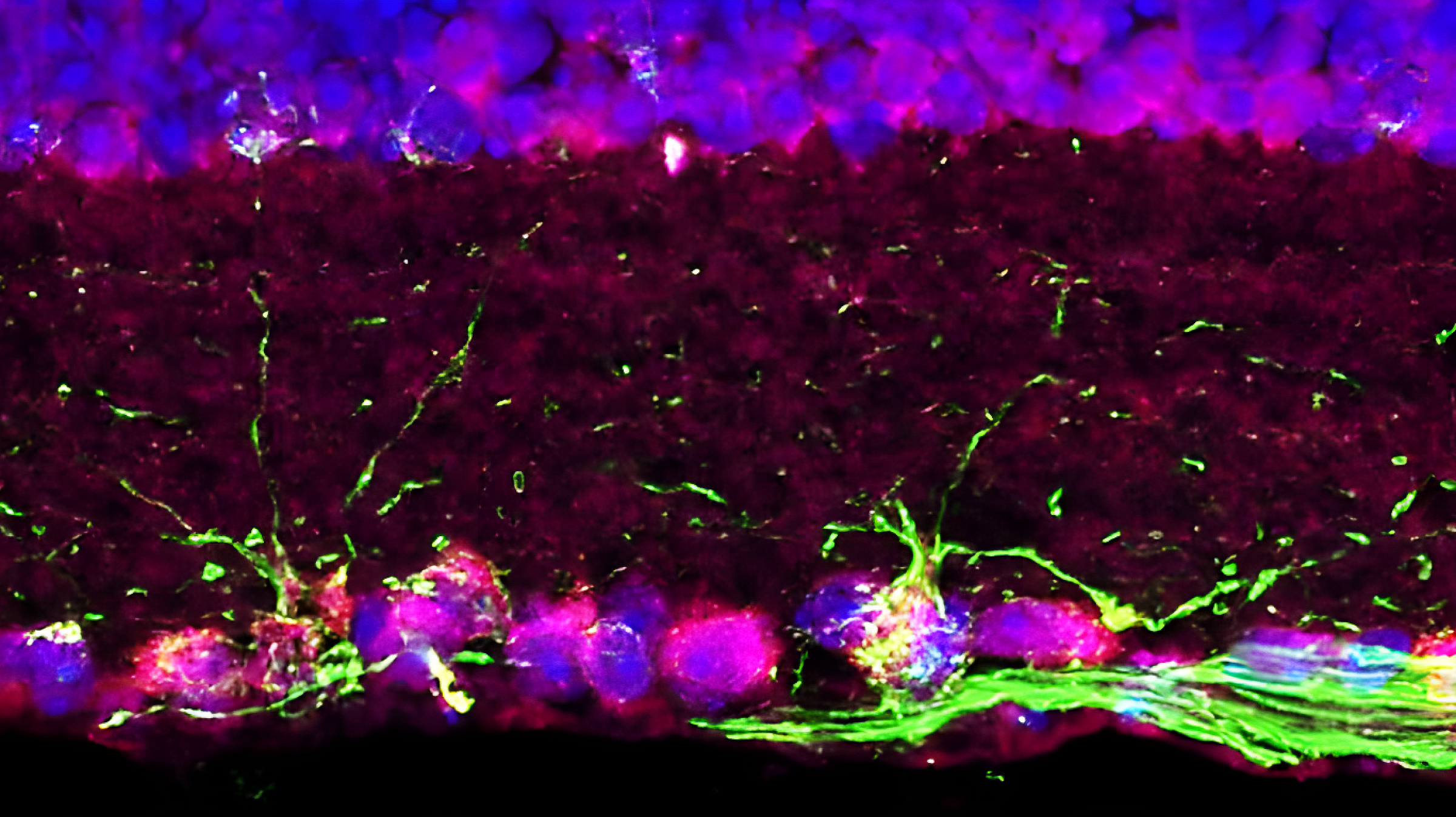 glaucoma research image