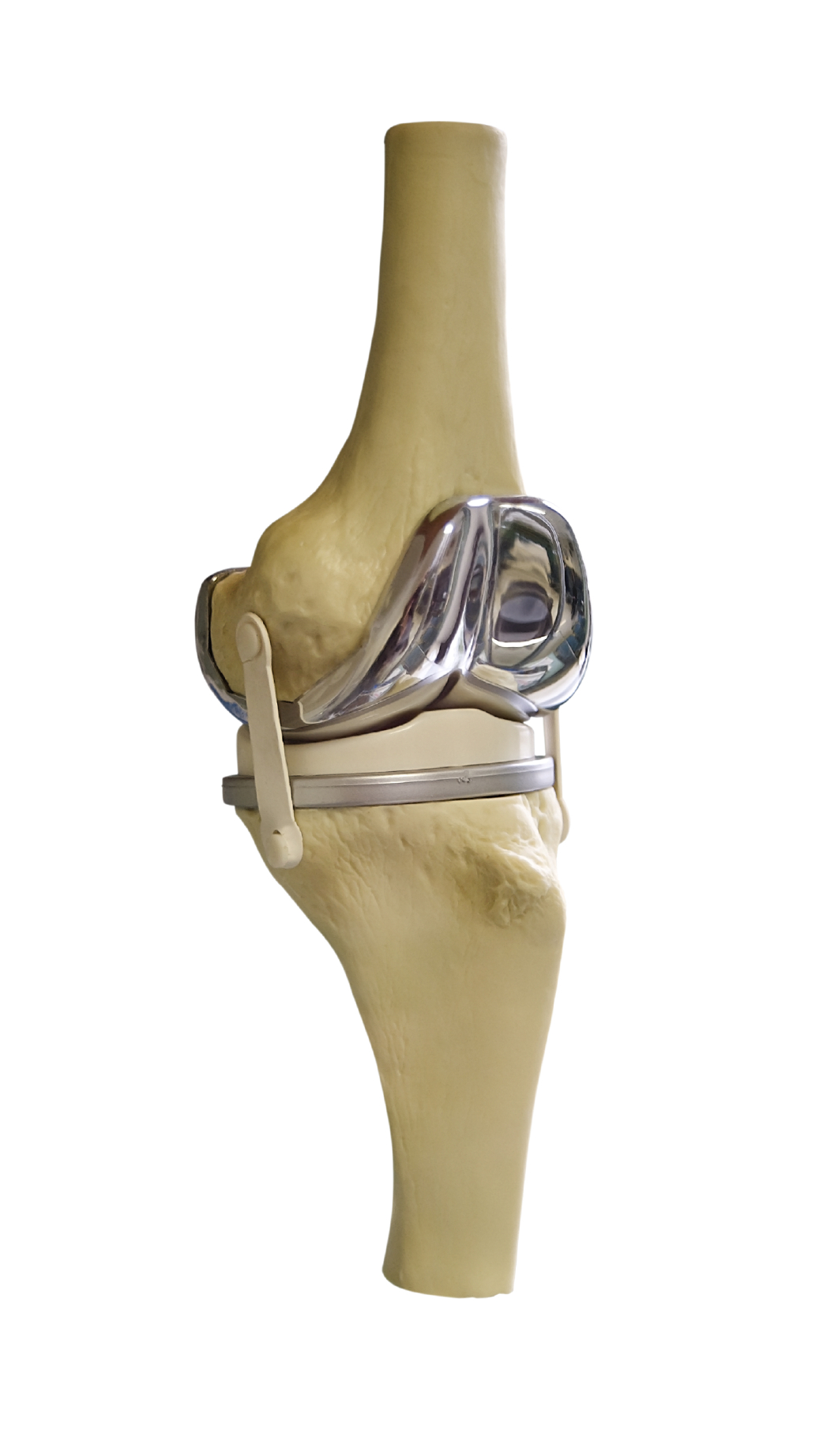 Knee Joint