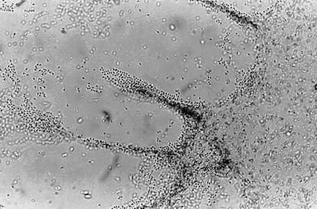 Fertility test showing interaction between sperm and cervical mucus.
