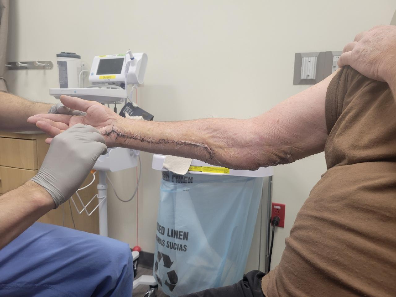 Gary Jones arm being examined by Dr. Goodenough following surgery
