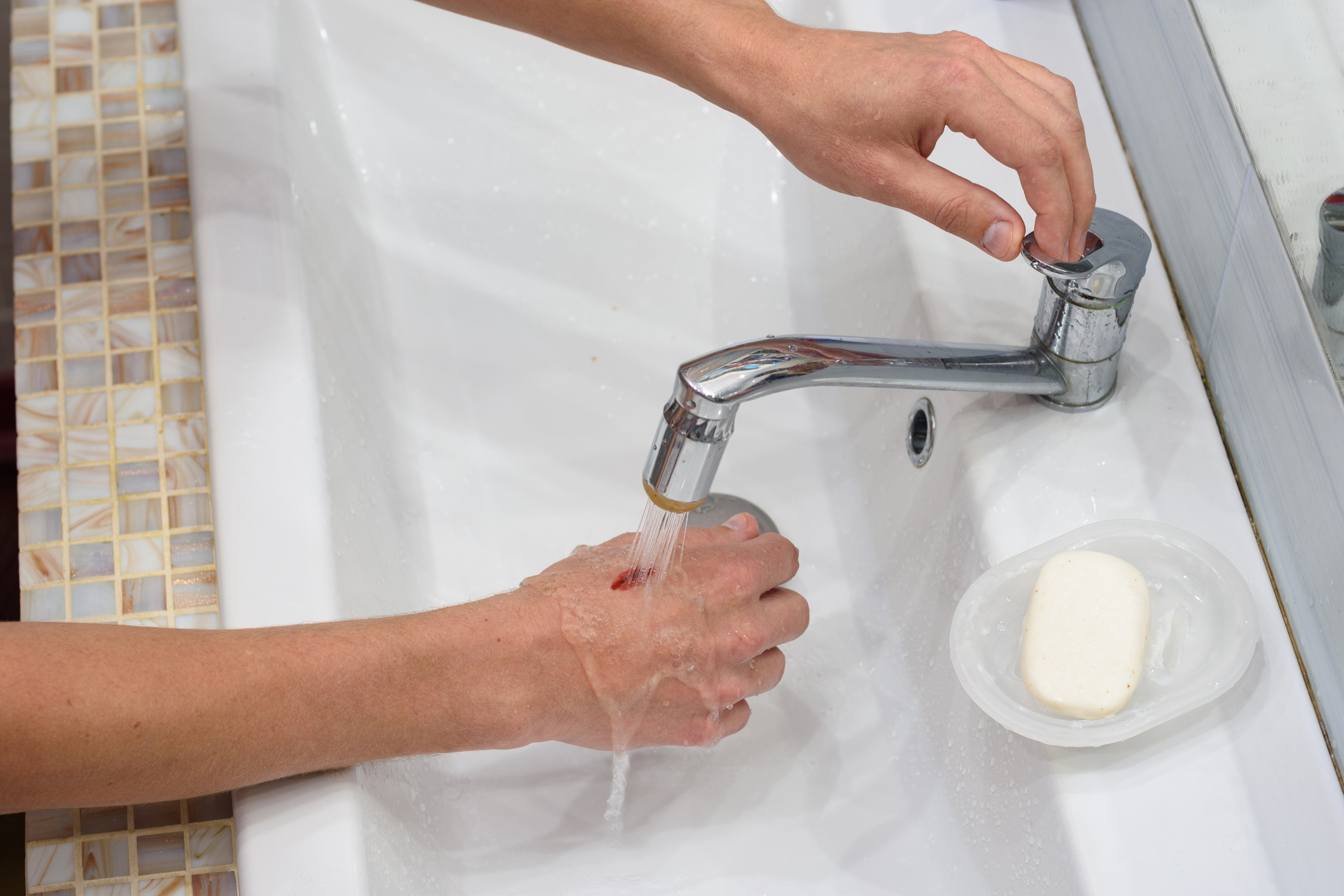 Should You Use Hydrogen Peroxide to Clean a Wound?