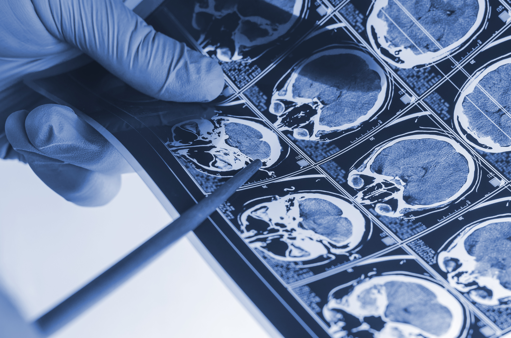 Seven Questions for a Functional Neurosurgeon