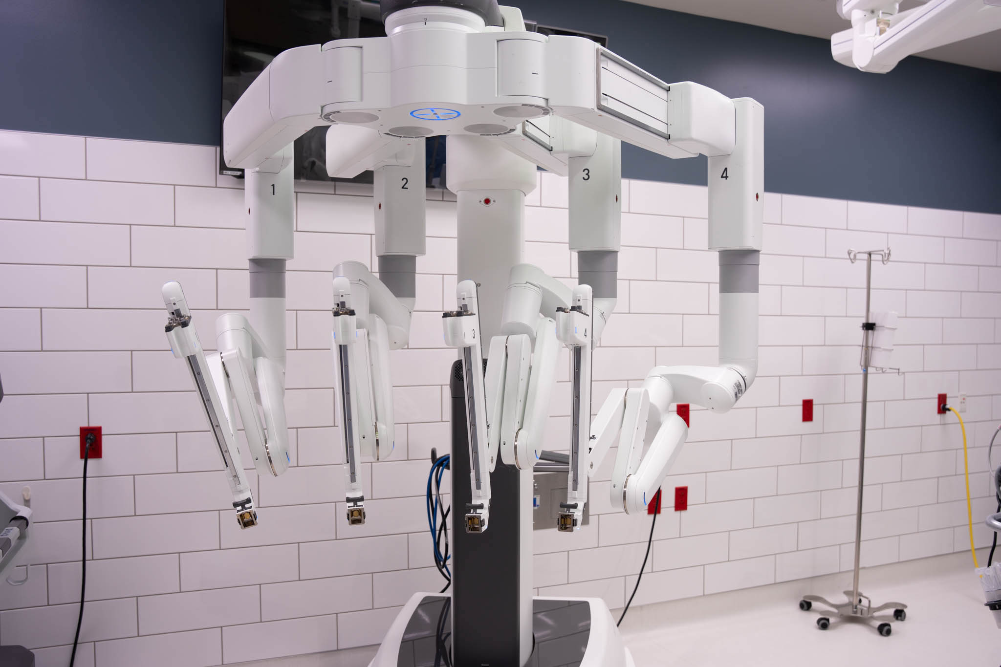robotic hernia repair