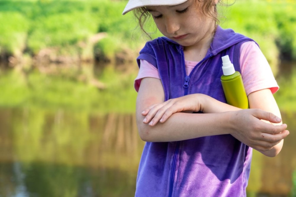Effective Strategies to Handle Mosquito Bites in Children