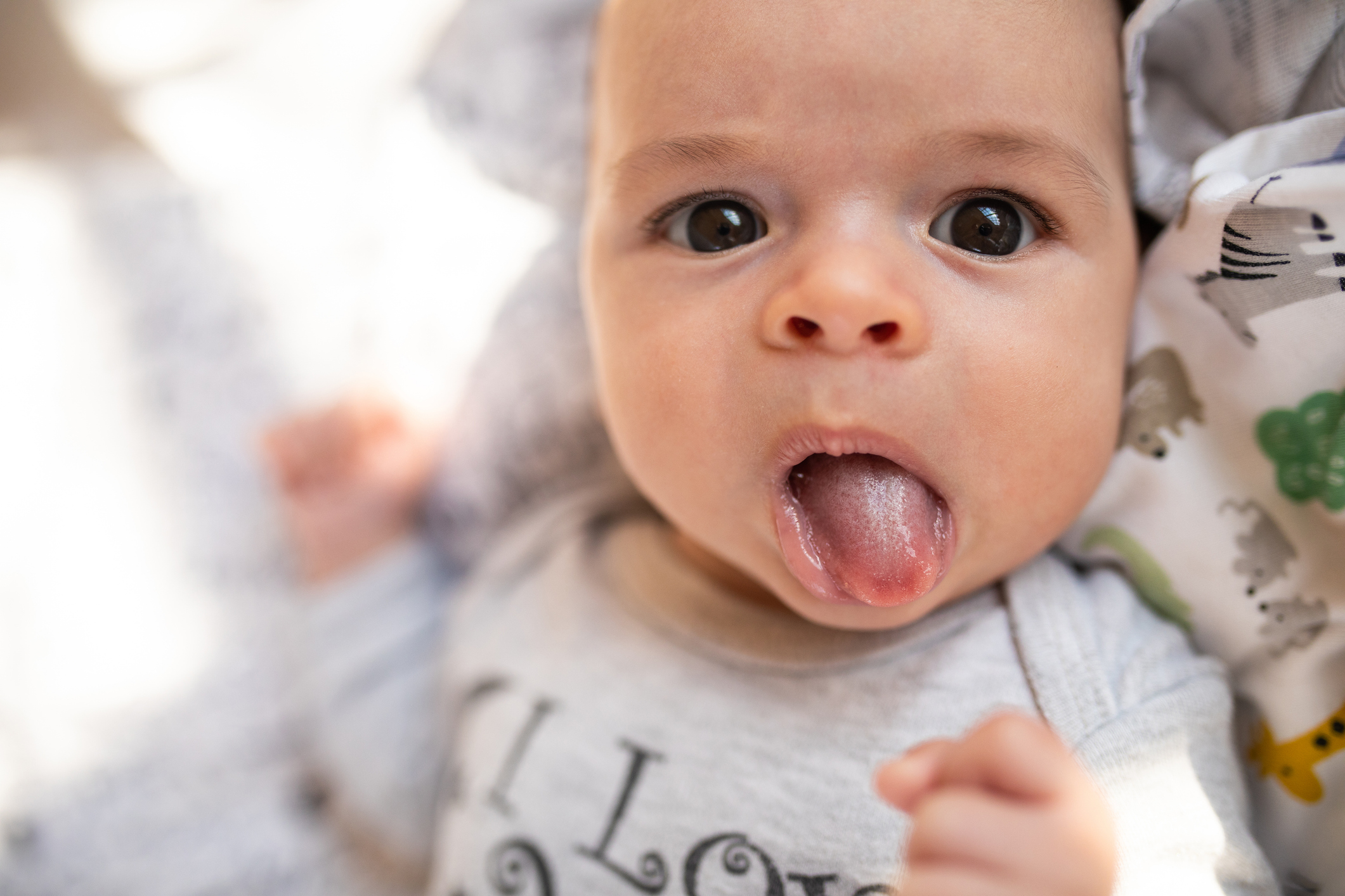 Does Your Baby Need Tongue-Tie Clipping?