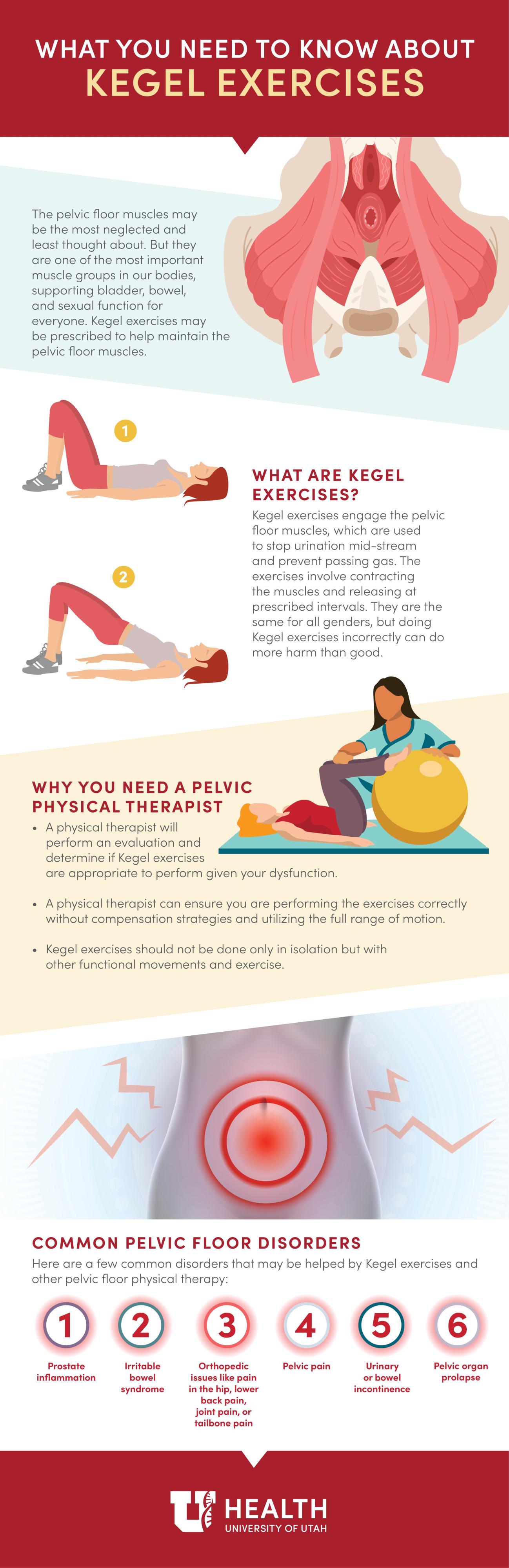 Kegal exercises infographic