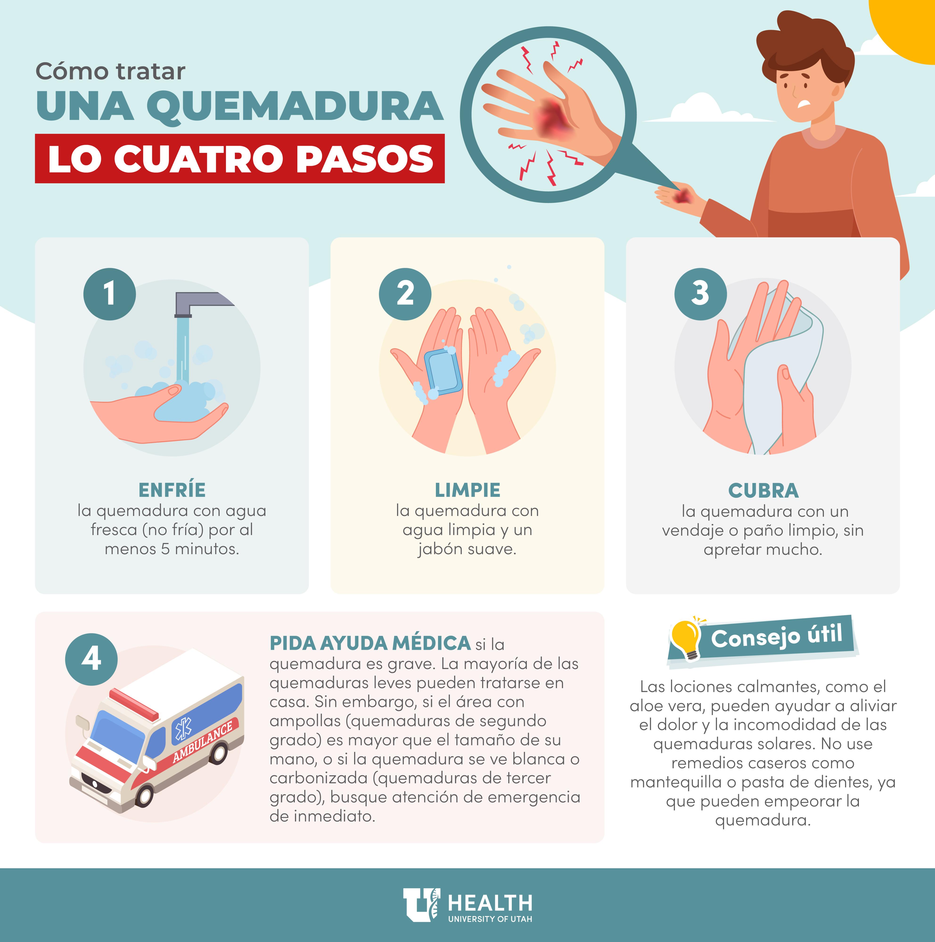 Four C's Burn Spanish Infographic