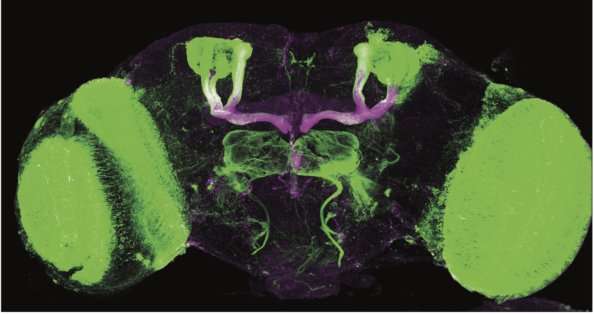 Fluorescent green-and-magenta microscope image of a fly brain.