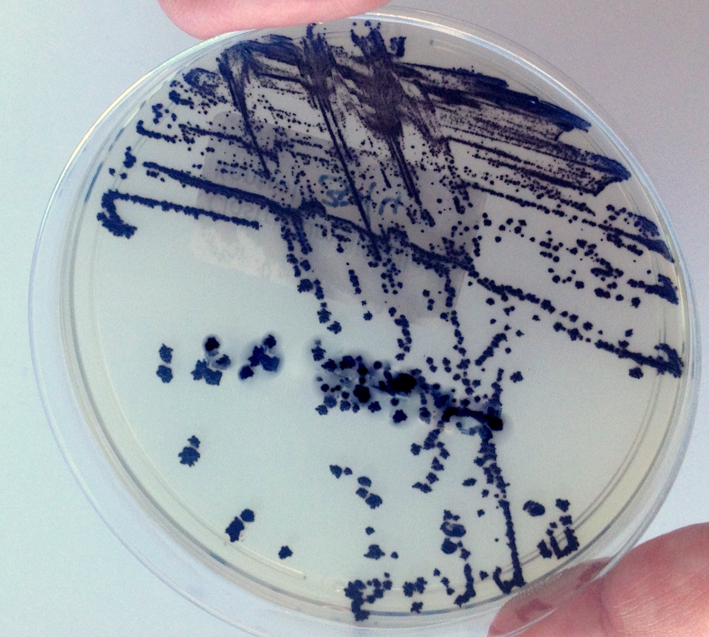 Close up of agar plate covered in dark blotches.