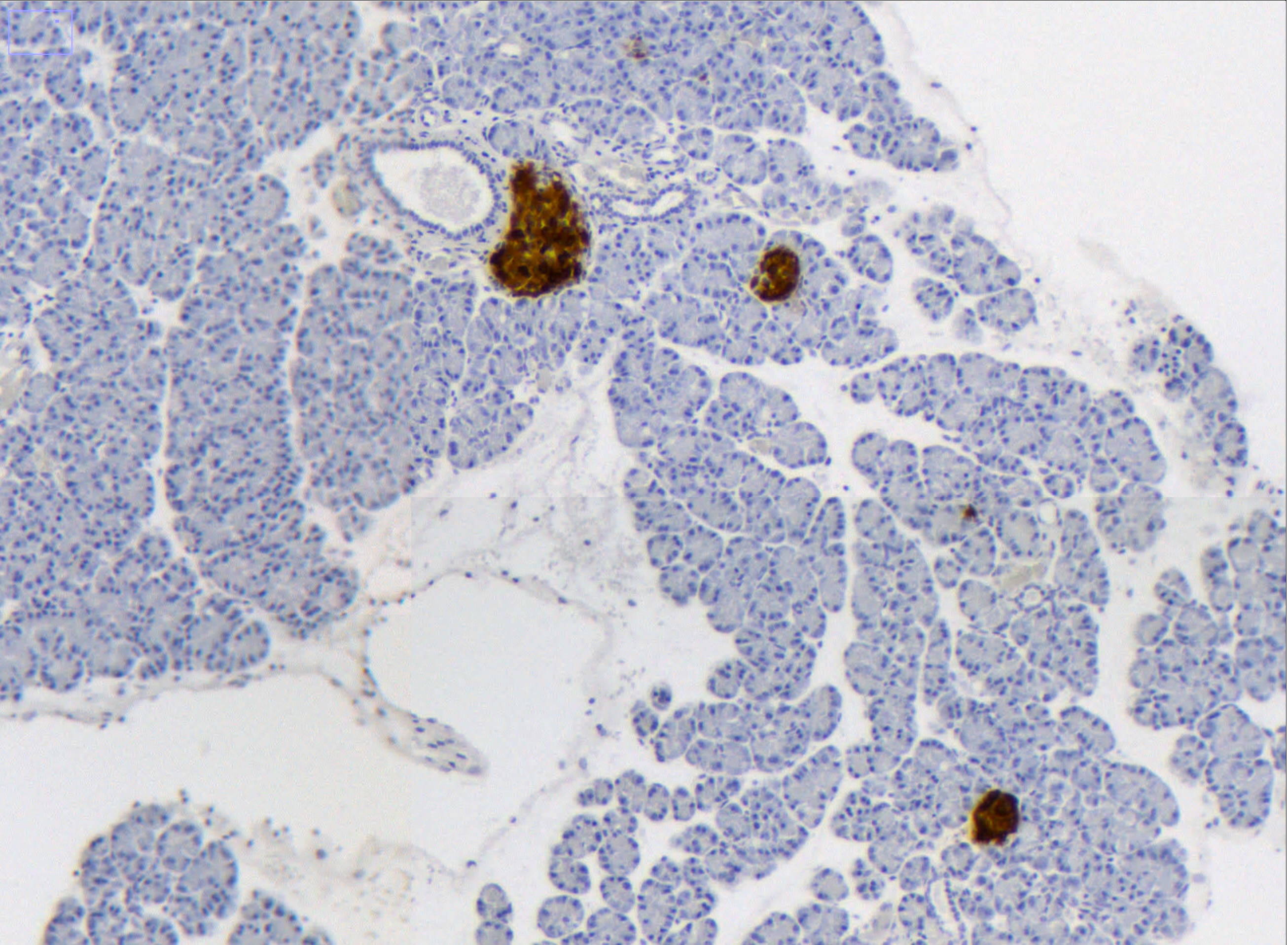 Microscope image of blue and brown cells in the pancreas.