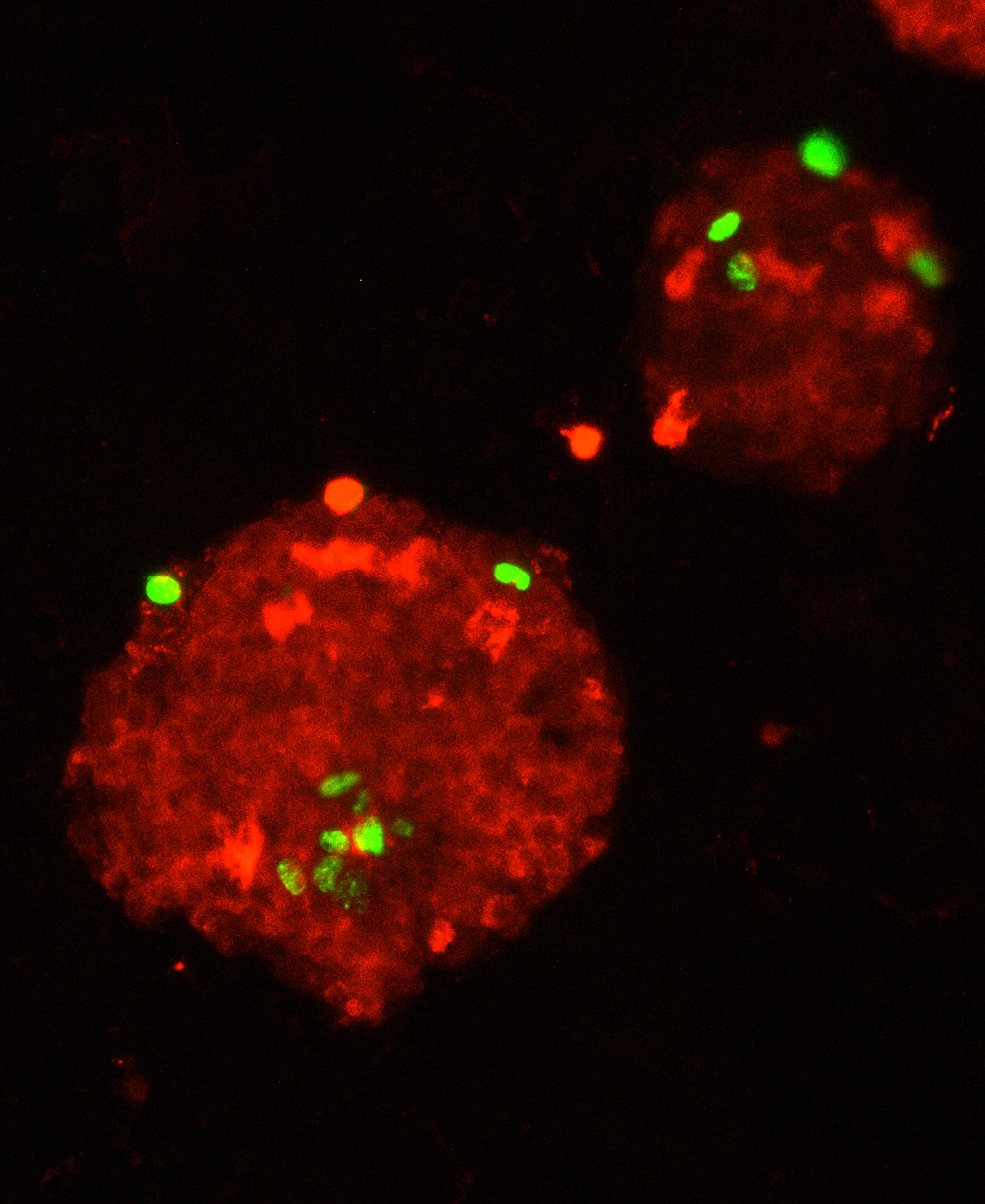 Fluorescent microscope image of red and green cells in the pancreas.