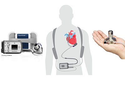 lvad