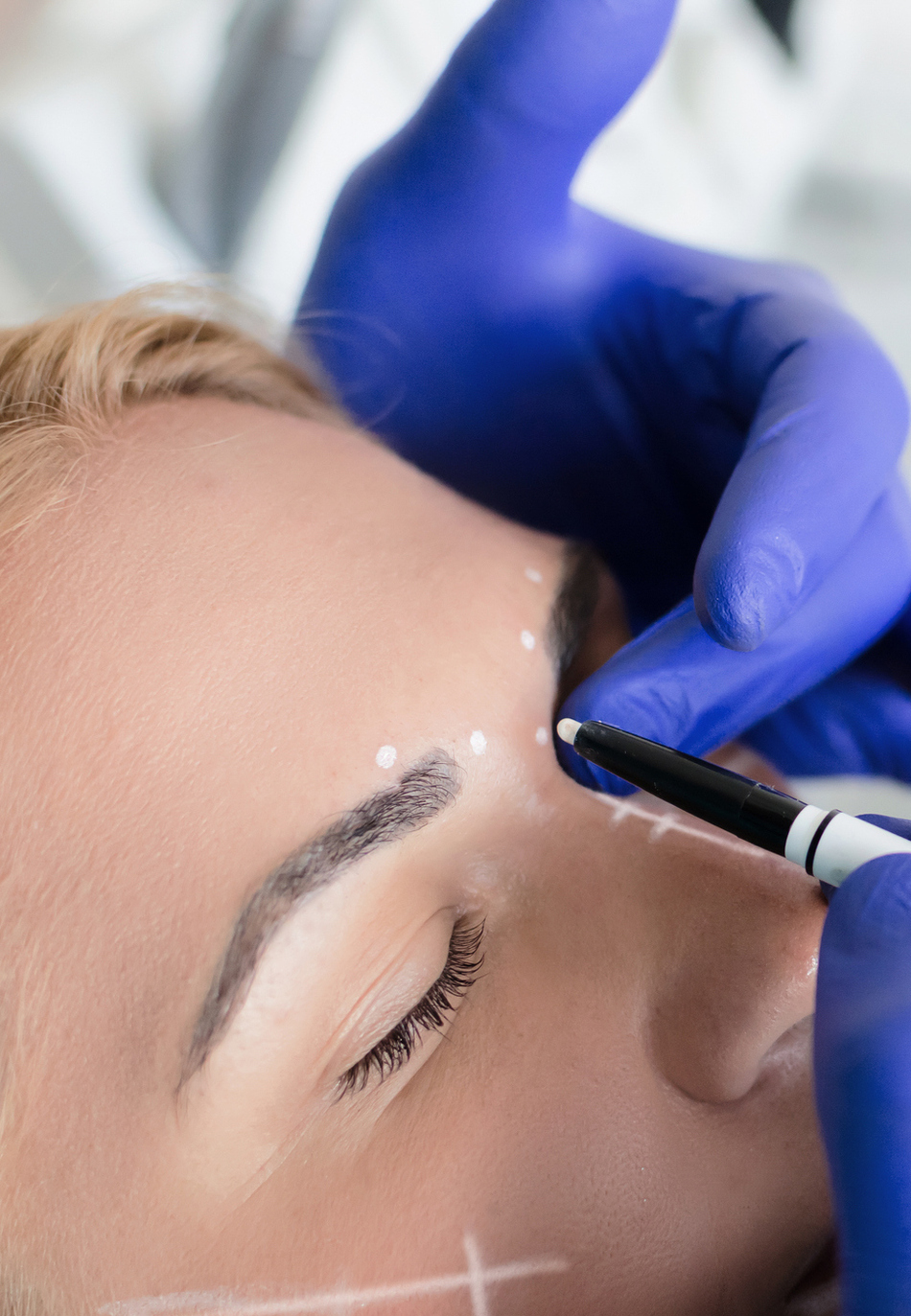 Choosing Between Botox vs. Fillers