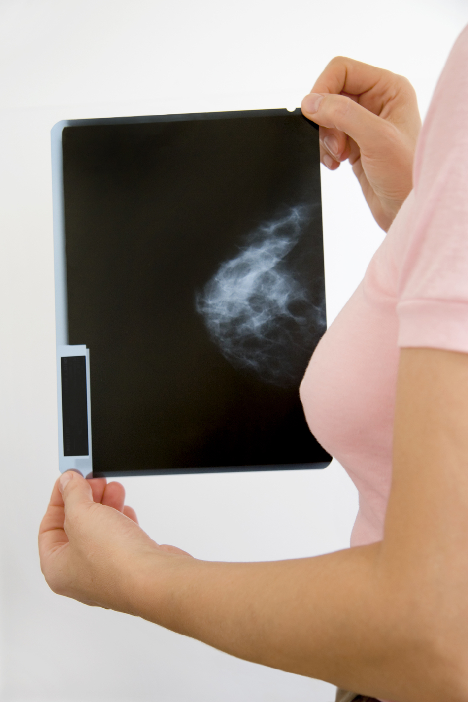 My Mammogram Came Back Abnormal. Now What?