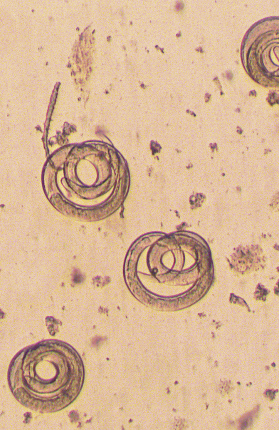 Tapeworms: Easy Weight Loss Or Potentially Fatal?