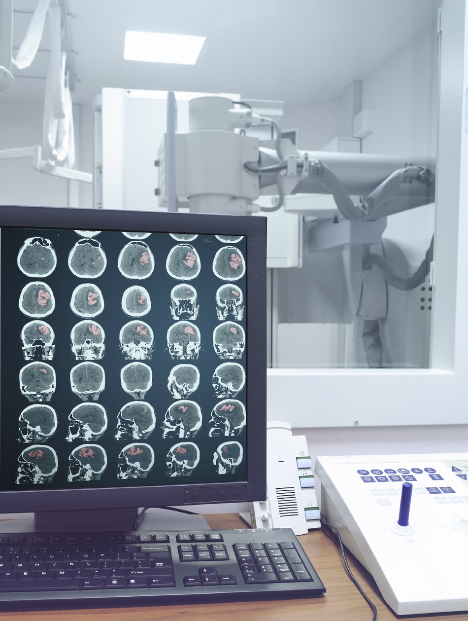CT vs MRI—Which Is Right For You?