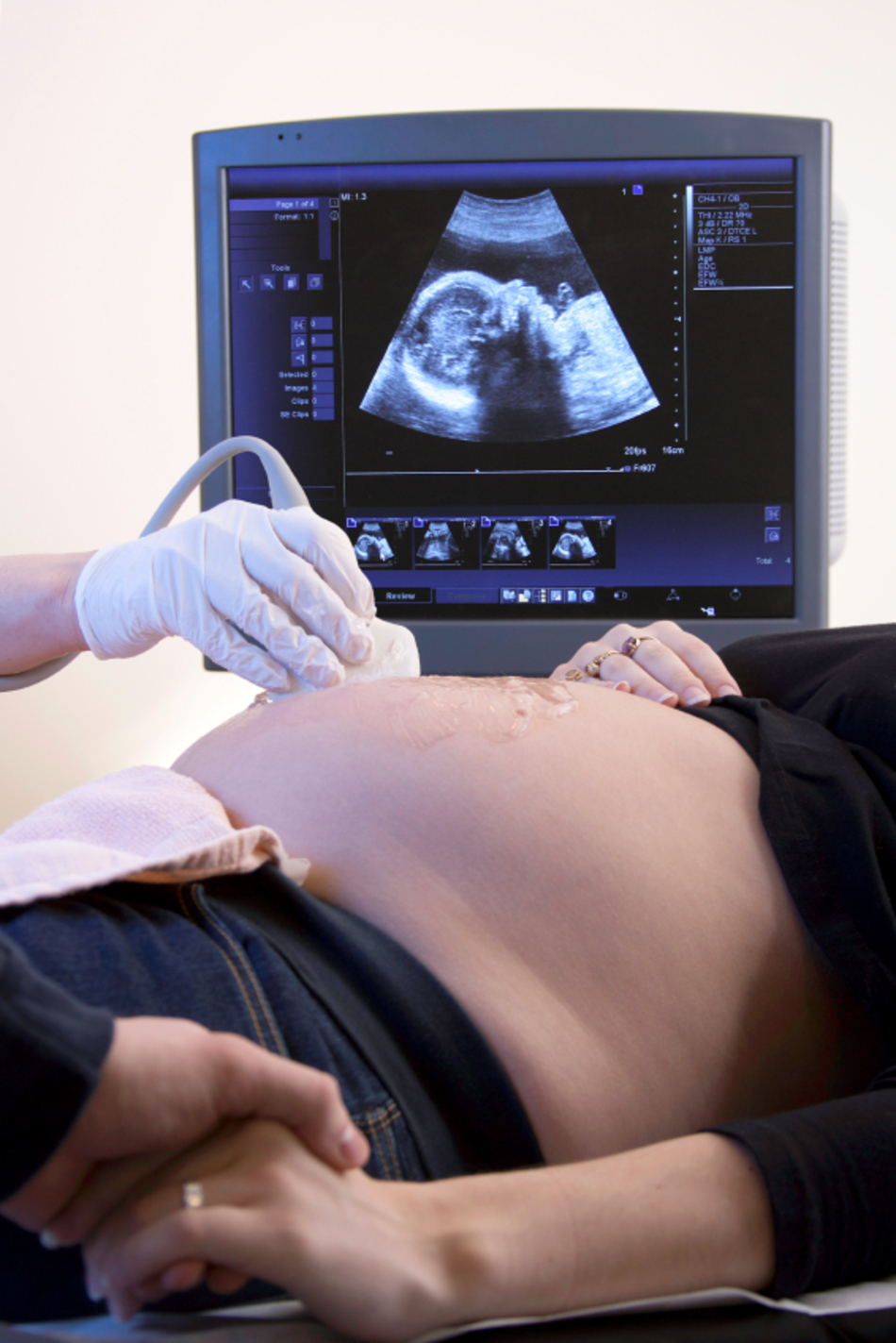 Steps You Can Take to Prevent Birth Defects in Your Baby