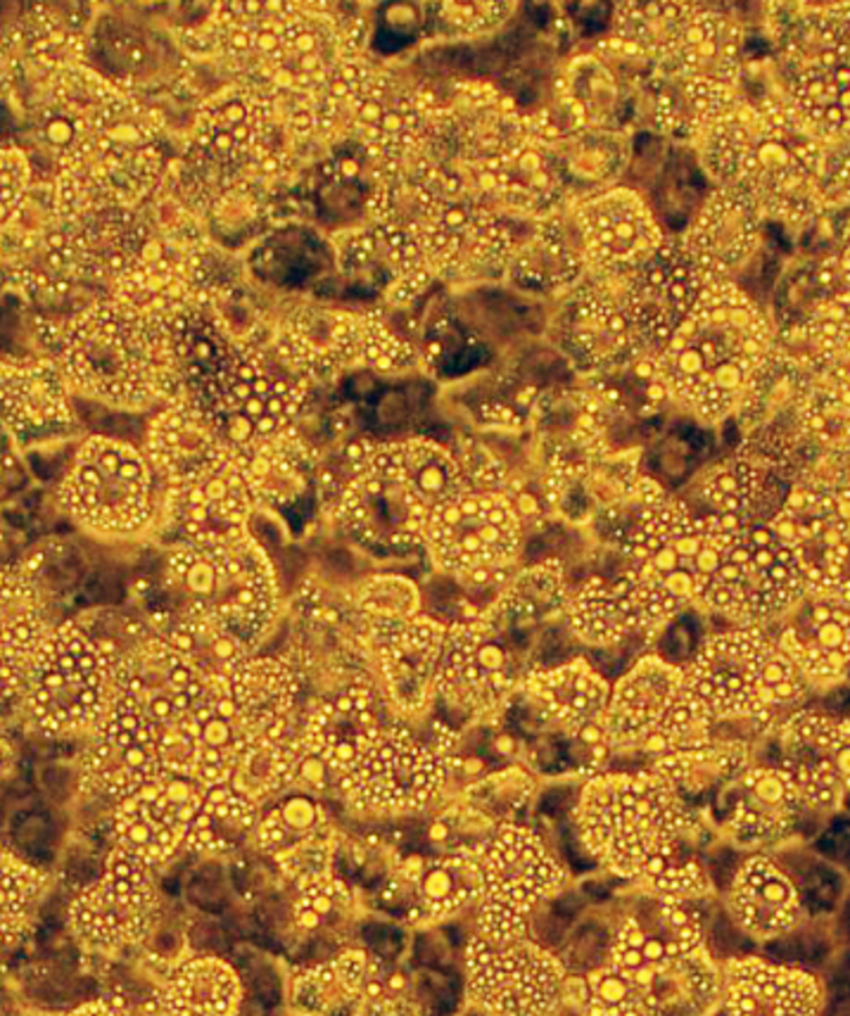 Brown Fat Stem Cells – The Good Fat