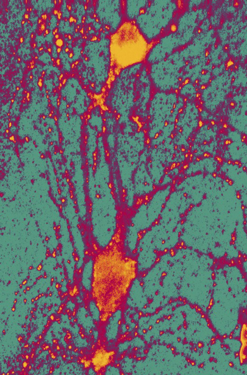 New Insights Into the Complexities of Autism