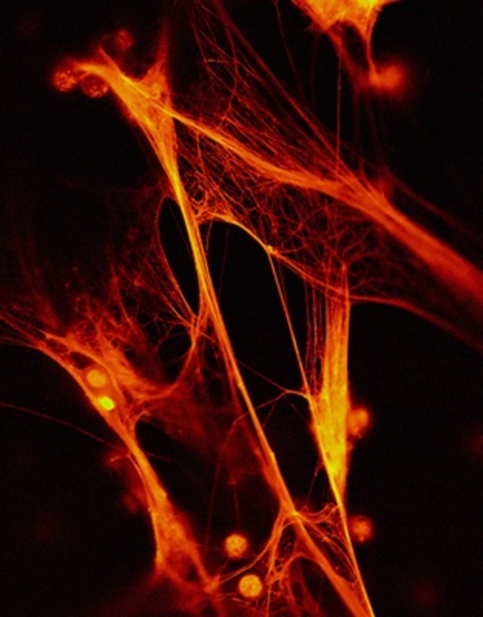 Stopping Sepsis With a Factor From Cord Blood