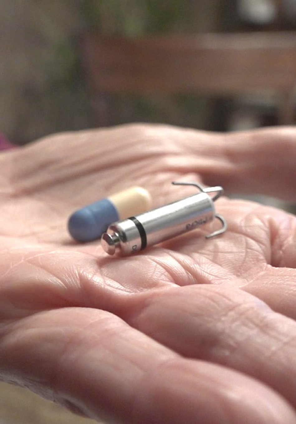 Vitamin-Sized, Leadless Pacemaker Transforms Use of Device