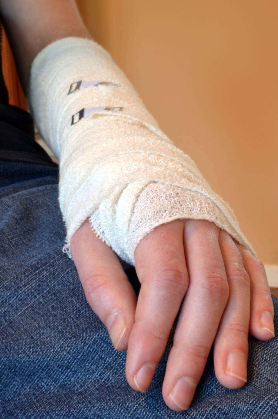 ER or Not: My Arm Might Be Broken
