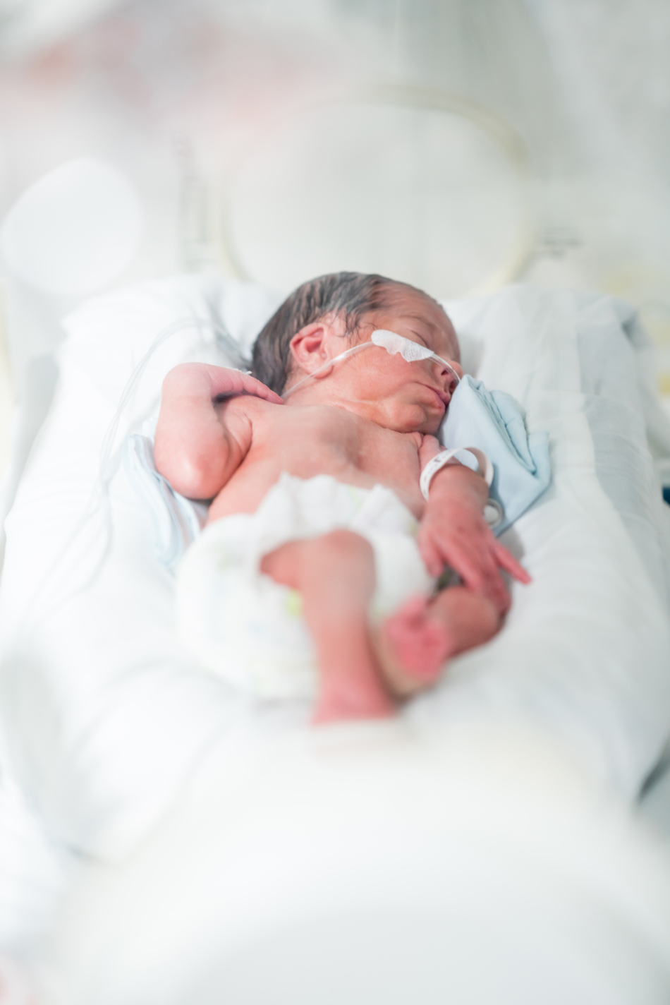 Pediatric Teratoma: What It Is and How It's Treated