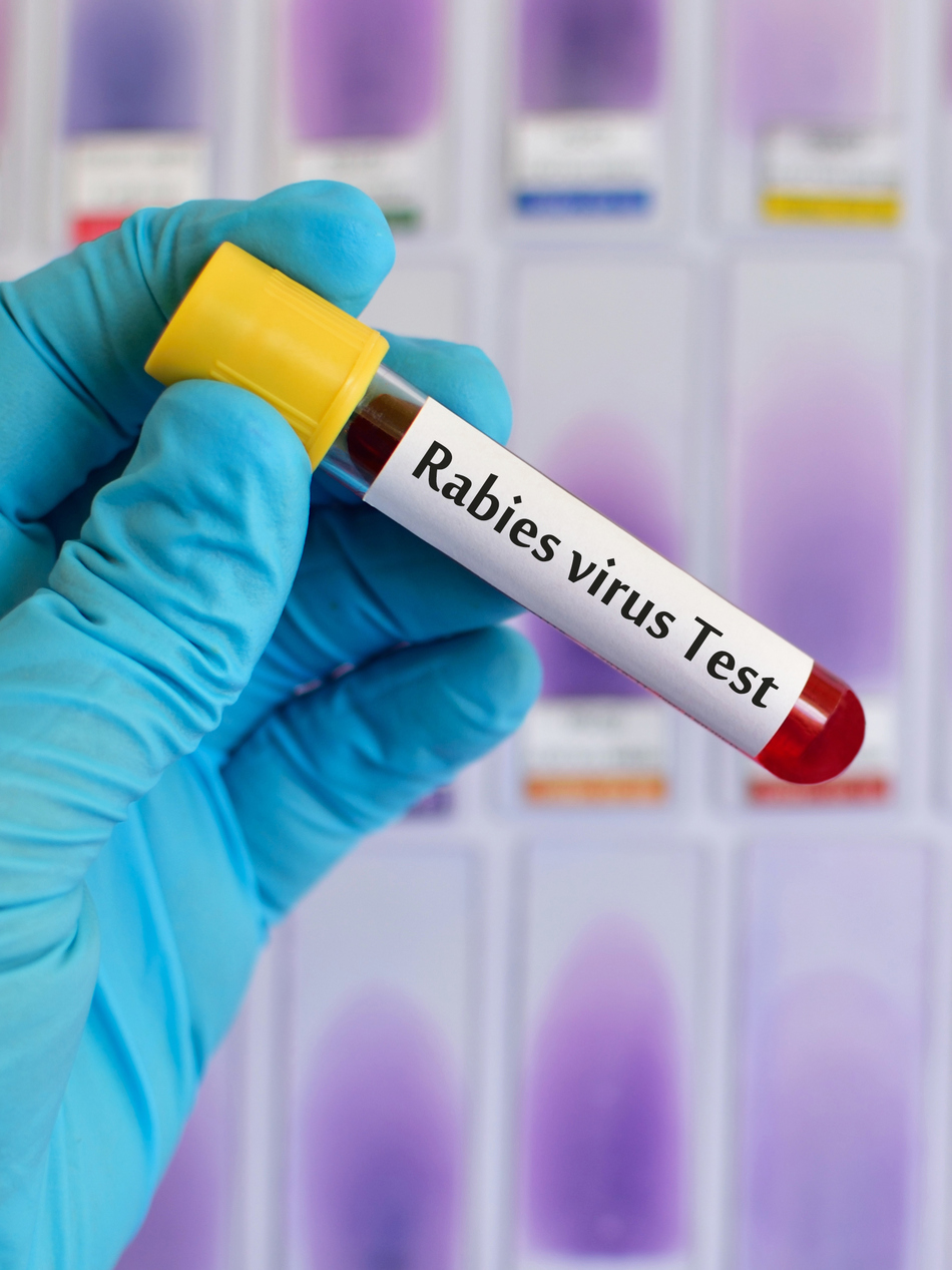 Could I Have Rabies? What to Look For and Steps to Take After an Animal Bite