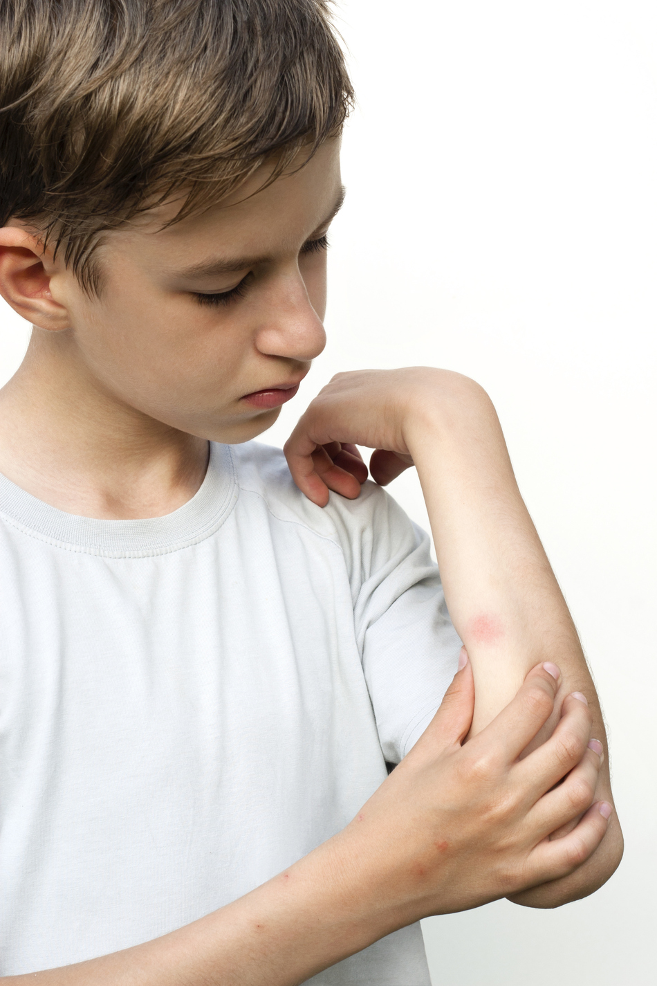 Debunking Old Wives' Tales: Bug Bites