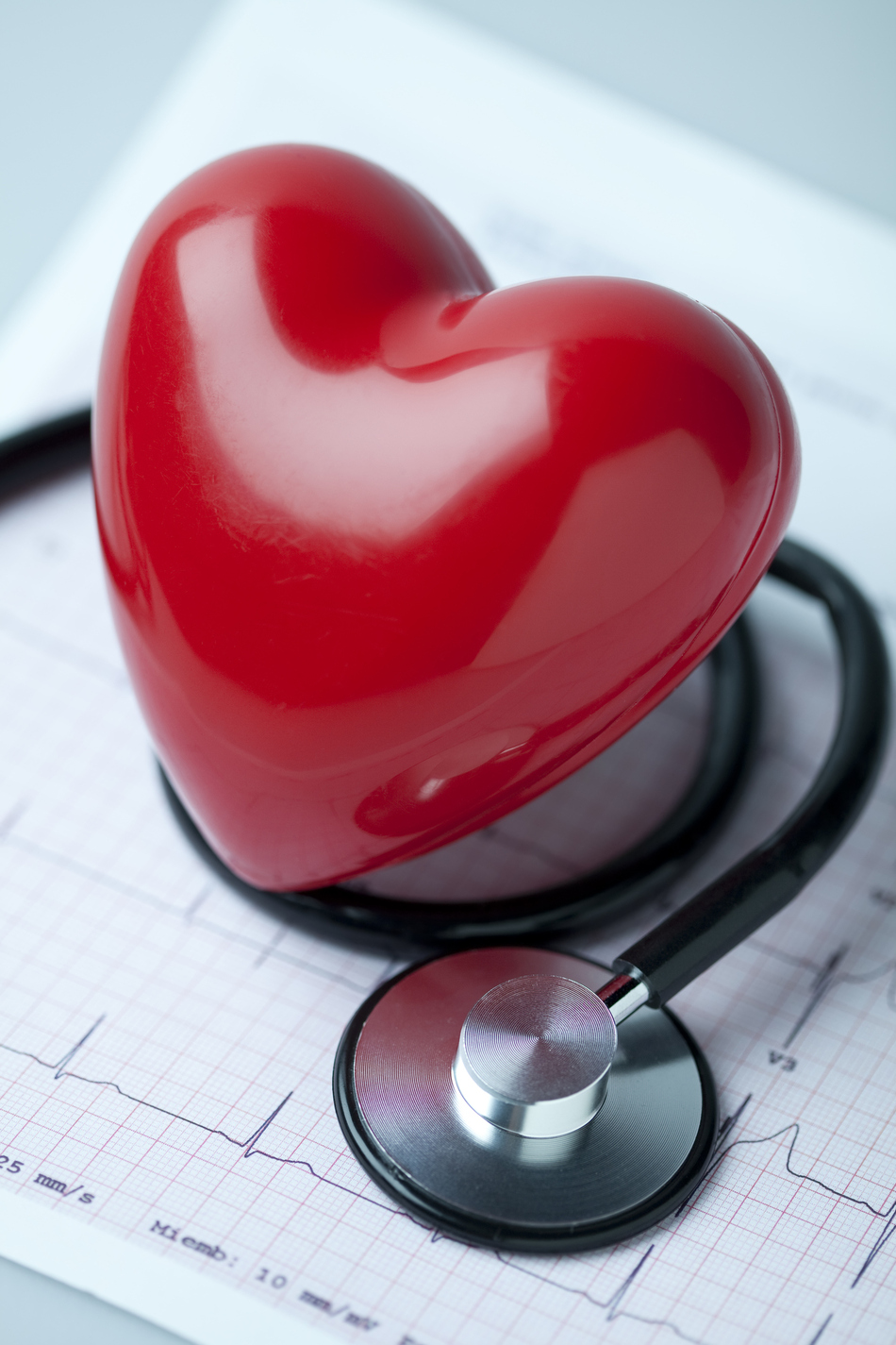 Catheter Ablation Works Better Than Traditional Atrial Fibrillation Therapies, Study Shows
