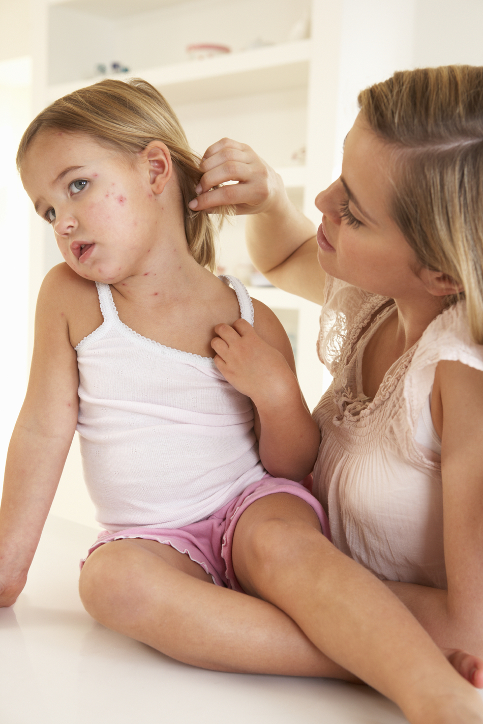 Time to Visit the Doctor for Your Child’s Chicken Pox?