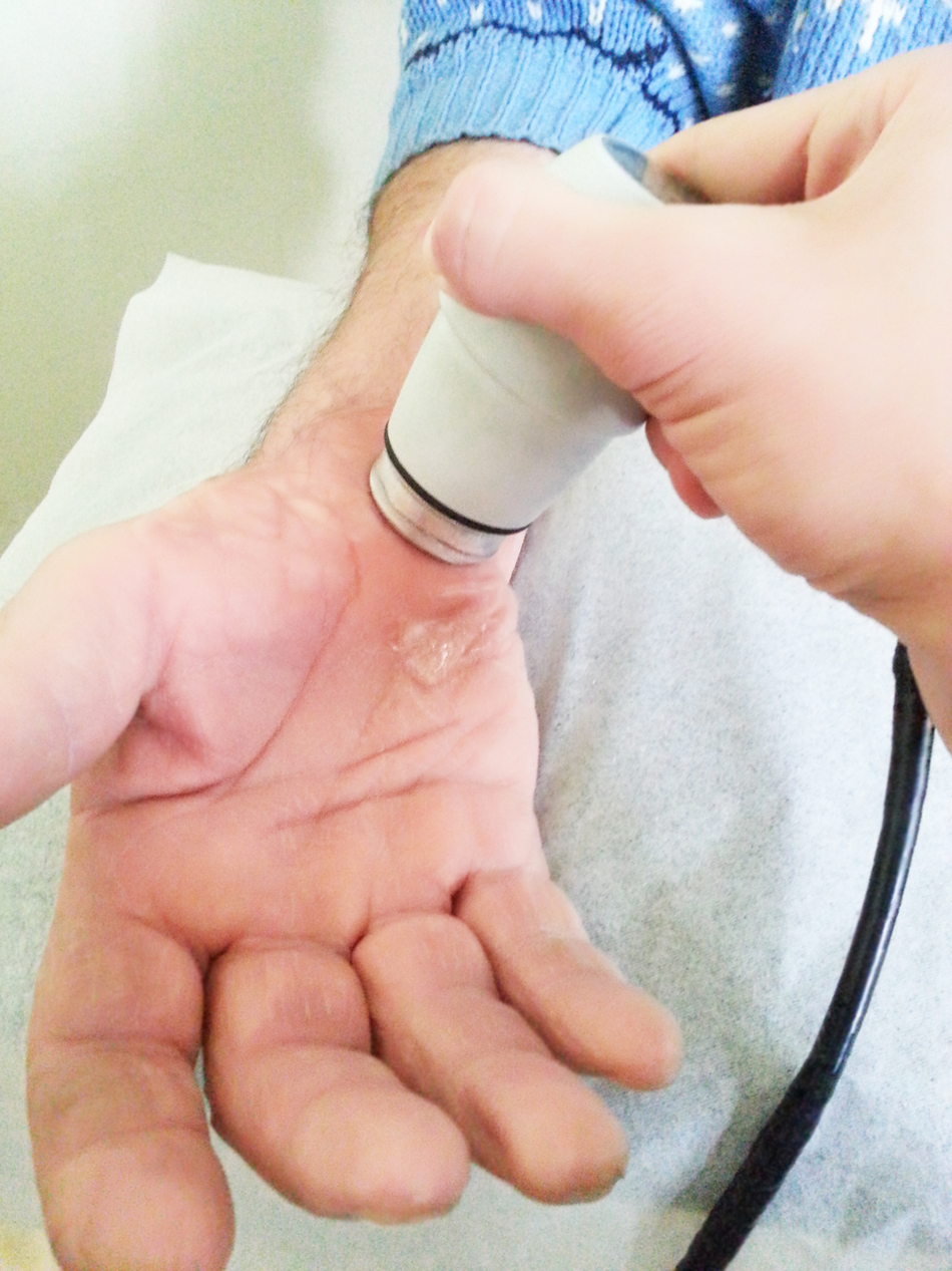 How Diagnostic Ultrasound Is Changing Orthopedics