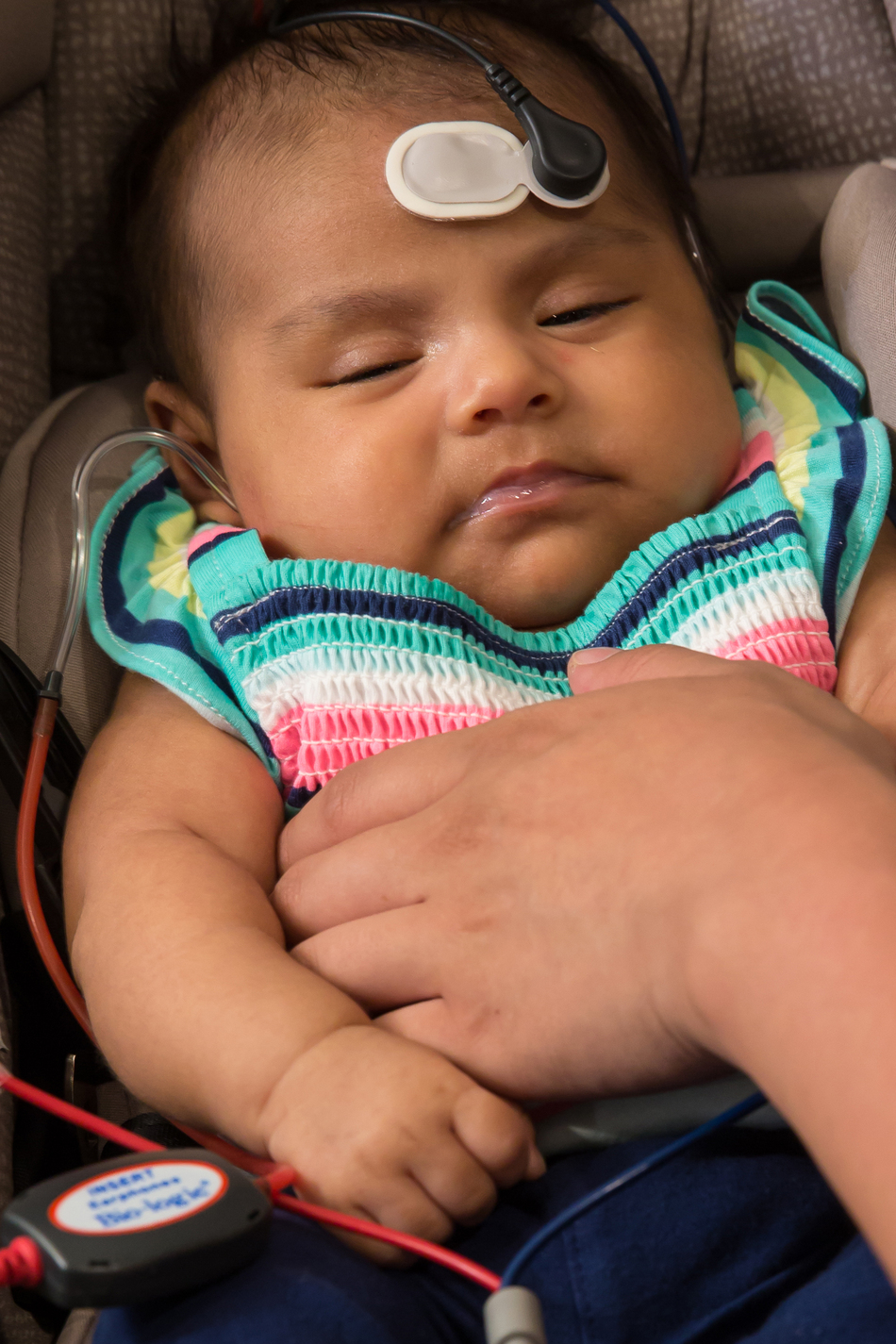 CMV: A Leading Cause of Newborn Hearing Loss that You’ve Never Heard Of