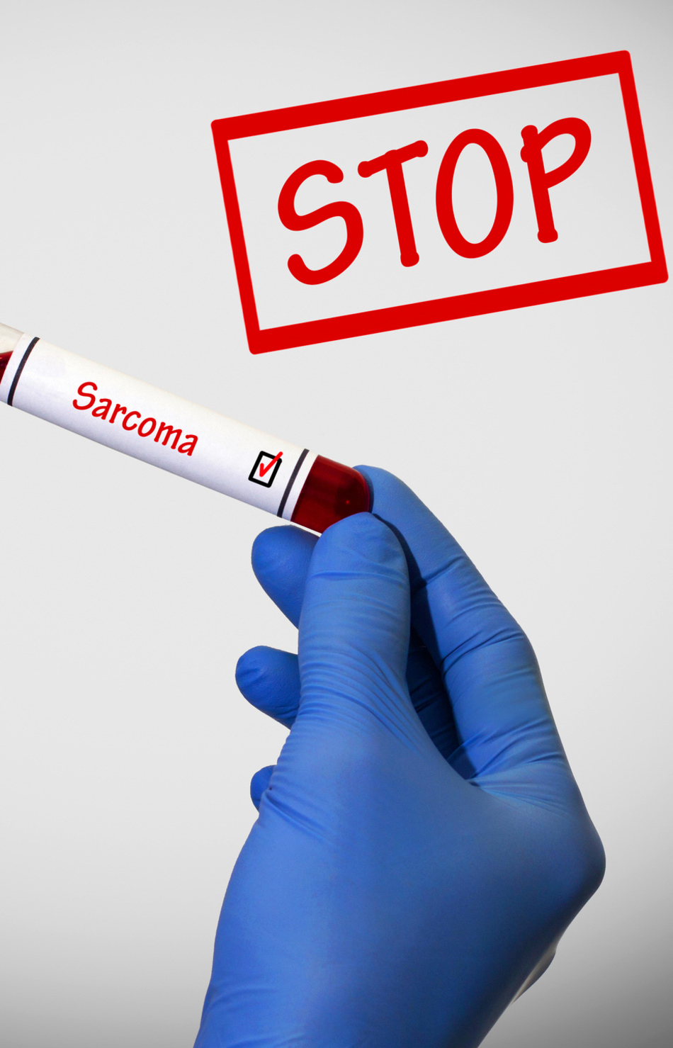 Treatment Options for Sarcoma