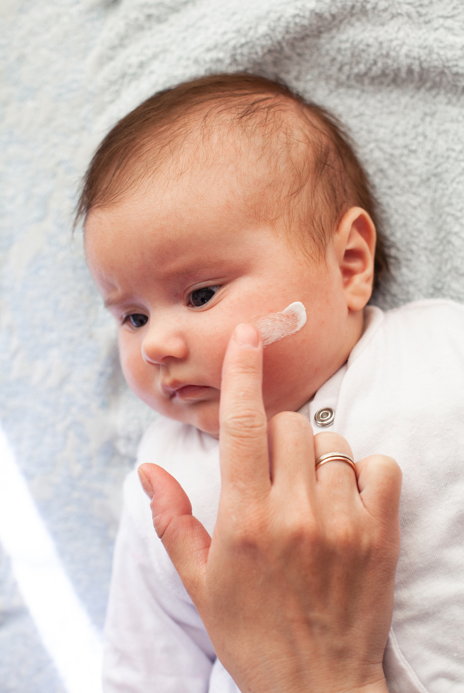 The Basics: Common Skin Conditions in Kids