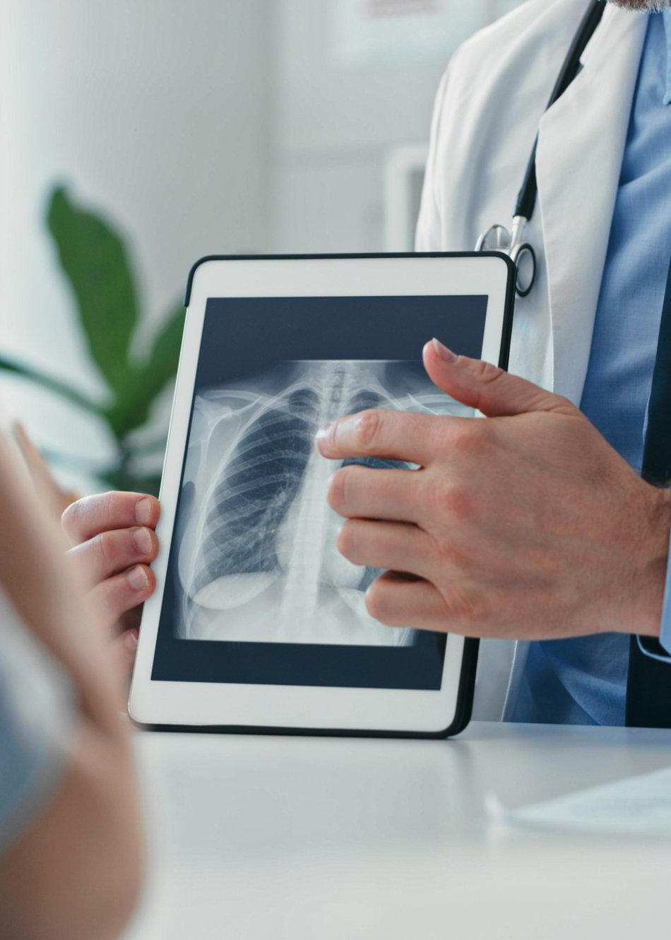 How to Choose a Lung Transplant Program