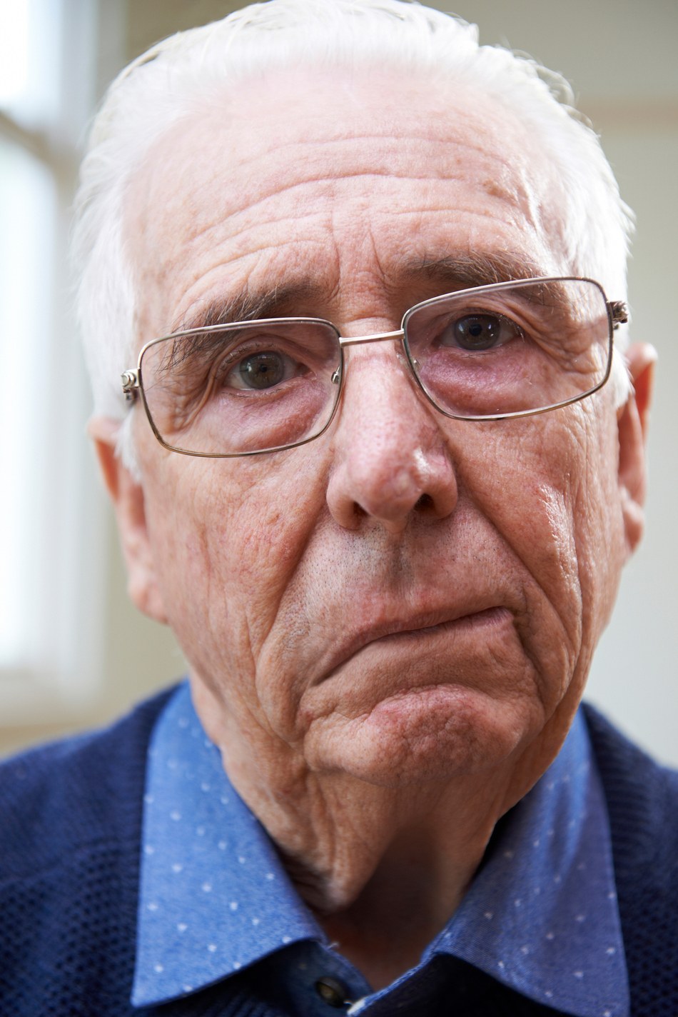 What Is Bell's Palsy?